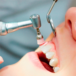 lina-fernandez-odontologia-profilaxis
