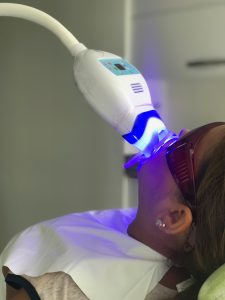 BLANQUEAMIENTO LED lina fernandez odontologia